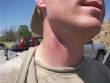 Paintball2009/Sean_Neck.jpg